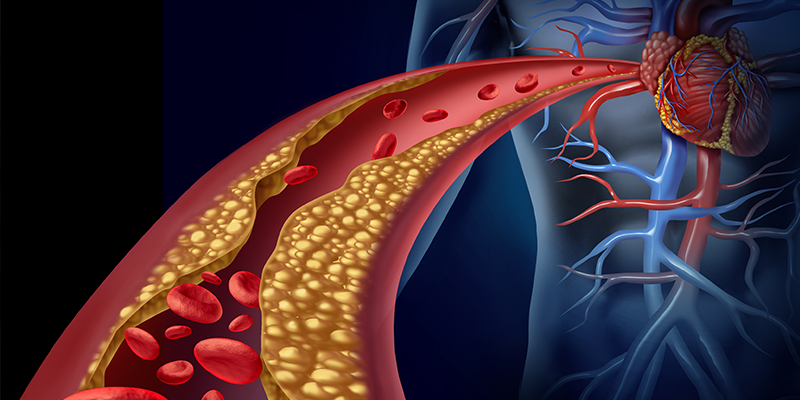 Blood Flow